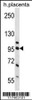 Western blot analysis in human placenta tissue lysates (35ug/lane) .