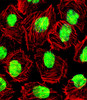 Fluorescent confocal image of U251 cell stained wit.U251 cells were fixed with 4% PFA (20 min) , permeabilized with Triton X-100 (0.1%, 10 min) , then incubated with NCL primary antibody (1:25) . For secondary antibody, Alexa Fluor 488 conjugated donkey anti-rabbit antibody (green) was used (1:400) .Cytoplasmic actin was counterstained with Alexa Fluor 555 (red) conjugated Phalloidin (7units/ml) . Nuclei were counterstained with DAPI (blue) (10 ug/ml, 10 min) . NCL immunoreactivity is localized to Nucleus significantly.