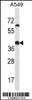 Western blot analysis in A549 cell line lysates (35ug/lane) .