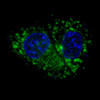 Fluorescent confocal image of HepG2 cells stained with ALDH1A1 antibody. HepG2 cells were fixed with 4% PFA (20 min) , permeabilized with Triton X-100 (0.2%, 30 min) . Cells were then incubated with ALDH1A1 primary antibody (1:100, 2 h at room temperature) . For secondary antibody, Alexa Fluor 488 conjugated donkey anti-rabbit antibody (green) was used (1:1000, 1h) . Nuclei were counterstained with Hoechst 33342 (blue) (10 ug/ml, 5 min) . ALDH1A1 immunoreactivity is localized to the cytoplasm of HepG2 cells.