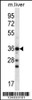 Western blot analysis in mouse liver tissue lysates (35ug/lane) .