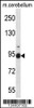 Western blot analysis in mouse cerebellum tissue lysates (35ug/lane) .