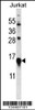 Western blot analysis in Jurkat cell line lysates (35ug/lane) .