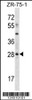 Western blot analysis in ZR-75-1 cell line lysates (35ug/lane) .