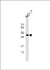 Western Blot at 1:1000 dilution + MCF-7 whole cell lysate Lysates/proteins at 20 ug per lane.