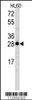 Western blot analysis of Latexin Antibody in HL60 cell line lysates (35ug/lane)