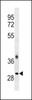 Western blot analysis in CEM cell line lysates (35ug/lane) .