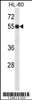 Western blot analysis in HL-60 cell line lysates (35ug/lane) .