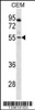 Western blot analysis in CEM cell line lysates (35ug/lane) .