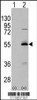 Western blot analysis of ALDH6A1 using rabbit polyclonal ALDH6A1 Antibody using 293 cell lysates (2 ug/lane) either nontransfected (Lane 1) or transiently transfected with the ALDH6A1 gene (Lane 2) .