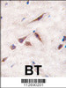 Formalin-fixed and paraffin-embedded human brain tissue reacted with ERAS antibody (A28) , which was peroxidase-conjugated to the secondary antibody, followed by DAB staining.