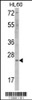 Western blot analysis of ERAS Antibody (F66) in HL60 cell line lysates (35ug/lane)