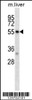 Western blot analysis in mouse liver tissue lysates (35ug/lane) .