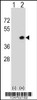 Western blot analysis of Dapk2 using rabbit polyclonal Mouse Dapk2 Antibody using 293 cell lysates (2 ug/lane) either nontransfected (Lane 1) or transiently transfected (Lane 2) with the Dapk2 gene.