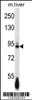 Western blot analysis in mouse liver tissue lysates (35ug/lane) .