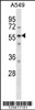 Western blot analysis in A549 cell line lysates (35ug/lane) .