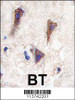 Formalin-fixed and paraffin-embedded human brain tissue reacted with CDH12 antibody, which was peroxidase-conjugated to the secondary antibody, followed by DAB staining.