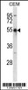 Western blot analysis in CEM cell line lysates (35ug/lane) .