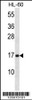 Western blot analysis in HL-60 cell line lysates (35ug/lane) .