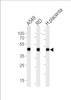 Western blot analysis in A549, RD cell line and human placenta lysates (35ug/lane) .This demonstrates the ACTA1/alpha -actin antibody detected the ACTA1/alpha -actin protein (arrow) .