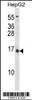 Western blot analysis in HepG2 cell line lysates (35ug/lane) .