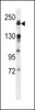 Western blot analysis in human normal Uterus tissue lysates (35ug/lane) .