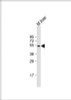 Western Blot at 1:2000 dilution + mouse liver lysate Lysates/proteins at 20 ug per lane.