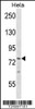 Western blot analysis in Hela cell line lysates (35ug/lane) .