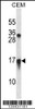 Western blot analysis in CEM cell line lysates (35ug/lane) .