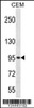 Western blot analysis in CEM cell line lysates (35ug/lane) .