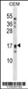 Western blot analysis in CEM cell line lysates (35ug/lane) .