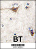 Formalin-fixed and paraffin-embedded human brain tissue reacted with CDH10 antibody (N-term) , which was peroxidase-conjugated to the secondary antibody, followed by DAB staining.