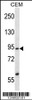 Western blot analysis in CEM cell line lysates (35ug/lane) .