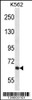 Western blot analysis in K562 cell line lysates (35ug/lane) .