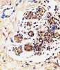 Antibody staining LALBA in Human breast tissue sections by Immunohistochemistry (IHC-P - paraformaldehyde-fixed, paraffin-embedded sections) .
