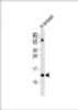 Western Blot at 1:2000 dilution + human breast lysates Lysates/proteins at 20 ug per lane.