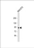 Western Blot at 1:1000 dilution + NIH/3T3 whole cell lysate Lysates/proteins at 20 ug per lane.