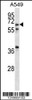 Western blot analysis in A549 cell line lysates (35ug/lane) .