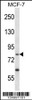 Western blot analysis in MCF-7 cell line lysates (35ug/lane) .