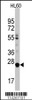 Western blot analysis of LIN28B Antibody in HL60 cell line lysates (35ug/lane)