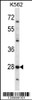 Western blot analysis in K562 cell line lysates (35ug/lane) .