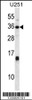 Western blot analysis in U251 cell line lysates (35ug/lane) .