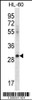 Western blot analysis in HL-60 cell line lysates (35ug/lane) .