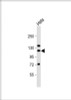 Western Blot at 1:1000 dilution + Hela whole cell lysate Lysates/proteins at 20 ug per lane.