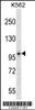 Western blot analysis in K562 cell line lysates (35ug/lane) .