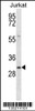 Western blot analysis in Jurkat cell line lysates (35ug/lane) .