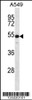 Western blot analysis in A549 cell line lysates (35ug/lane) .