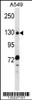 Western blot analysis in A549 cell line lysates (35ug/lane) .