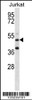 Western blot analysis in Jurkat cell line lysates (35ug/lane) .