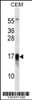 Western blot analysis in CEM cell line lysates (35ug/lane) .